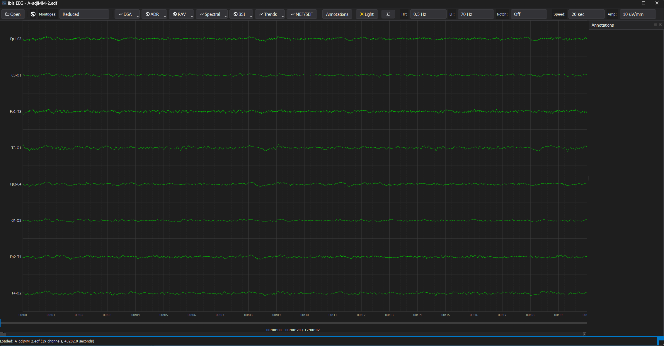 Base EEG - Dark Theme