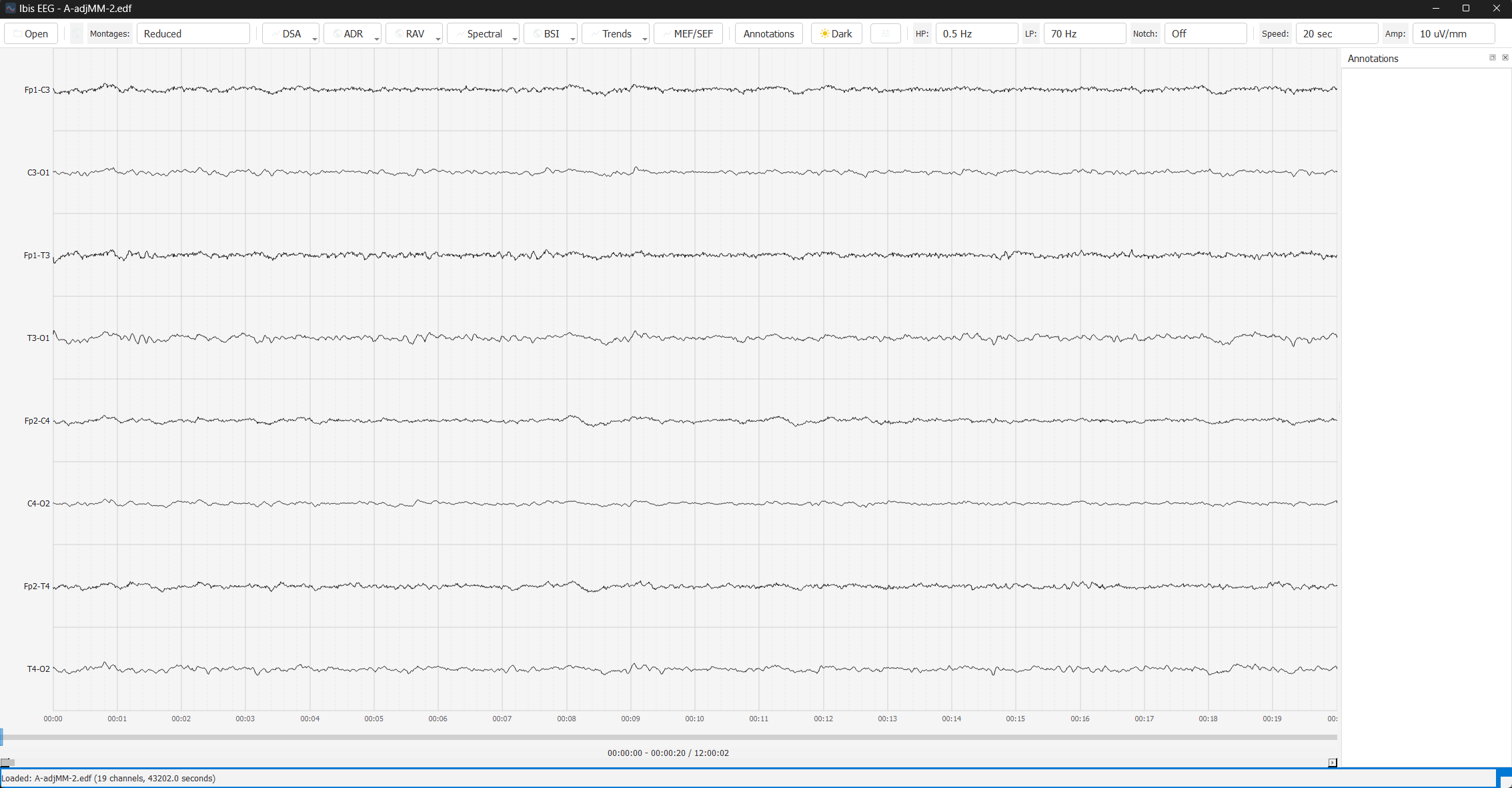 Base EEG - Light Theme