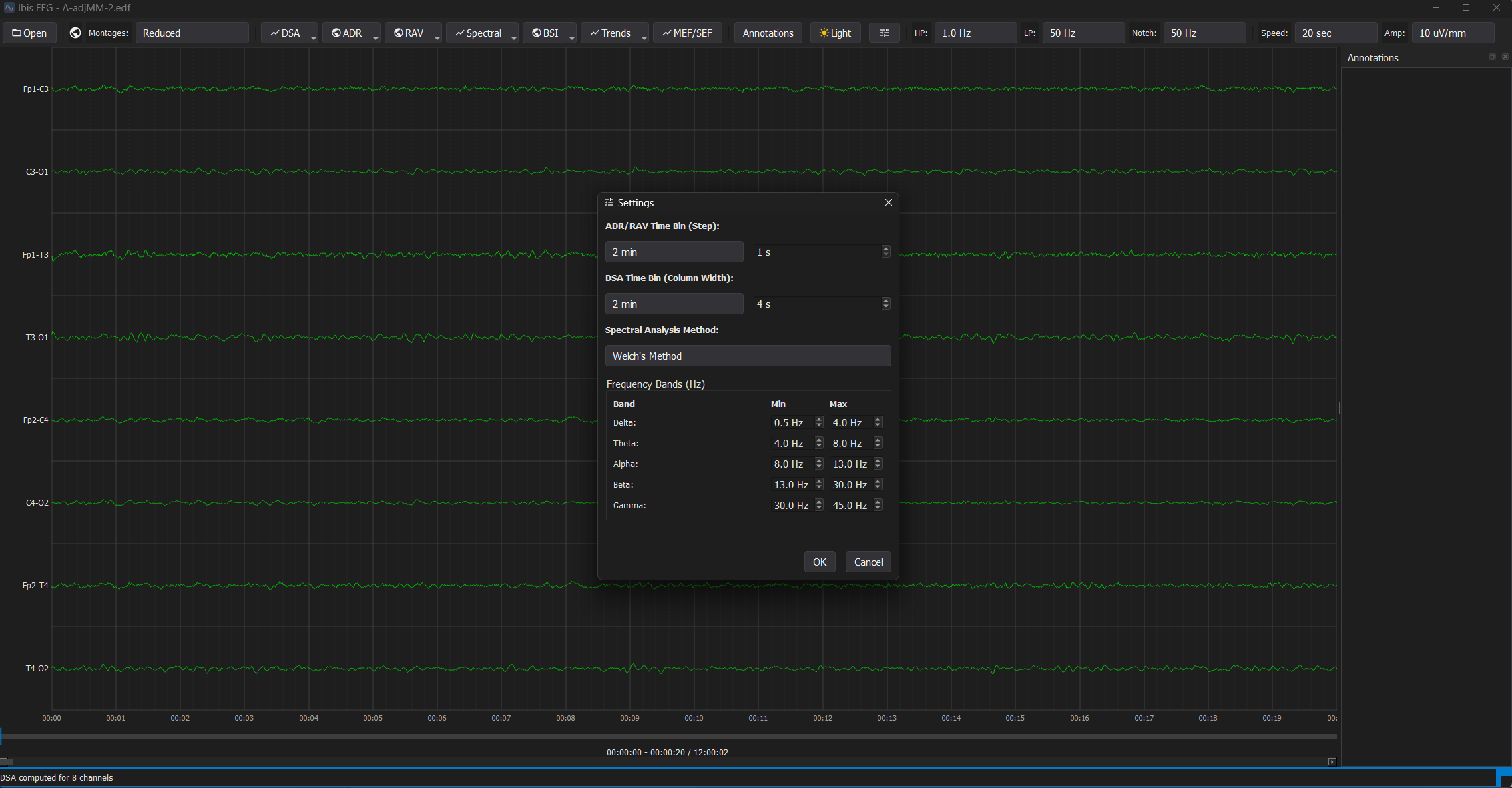 Settings - Dark Theme