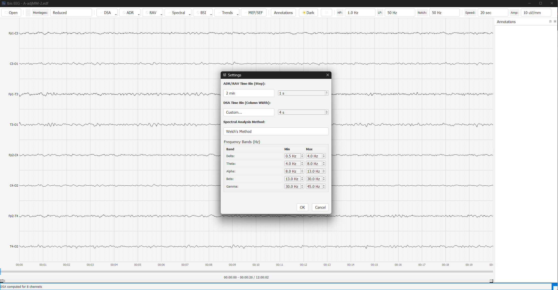 Settings - Light Theme